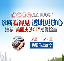 广州308准分子激光